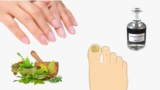 How To Treat Green Nails At Home?